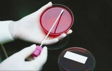 Allergietests - auf der Suche nach den Ursachen